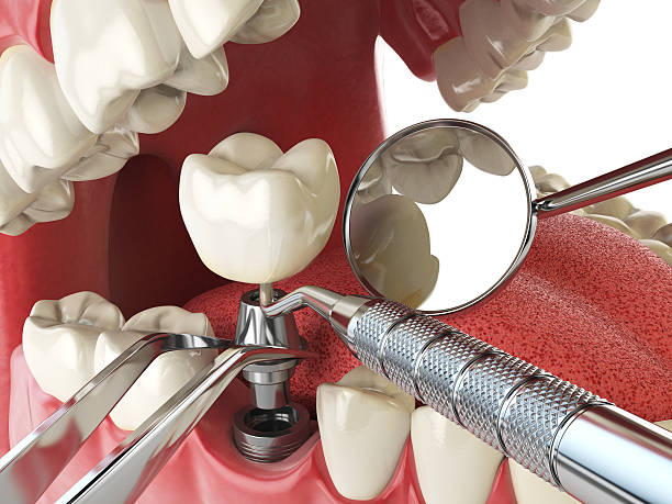 Best Emergency Dental Surgery in Lucerne Valley, CA